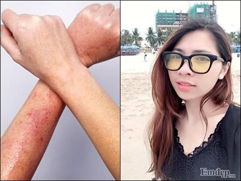 Nữ sinh trường Y chỉ cách triệt 'sạch sành sanh' lông tay chân và mụn lưng