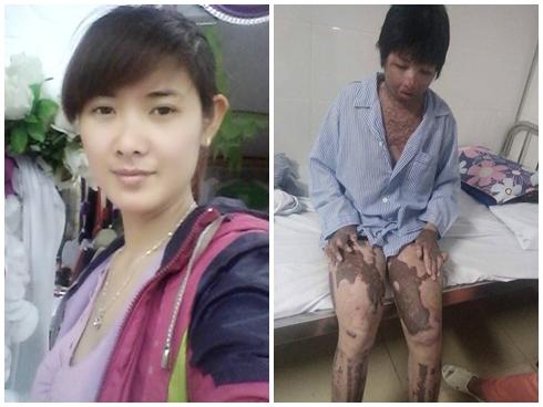 Giận vợ, chồng tưới xăng dọa đốt nhà, lửa bùng cháy gây bỏng cho cả đứa con mới hơn 2 tuổi-9