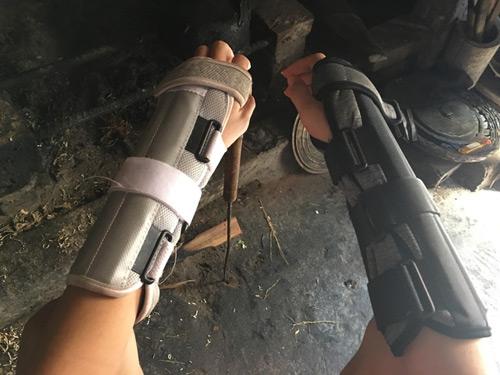 nguoi-con-trai-bi-bo-bop-ran-xuong-tay-trong-vu-xich-co-vo-o-thai-binh2