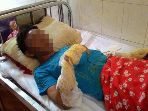 Tin nóng trong ngày 16/6: Nổ khí ga khiến 10 người trong một gia đình bị bỏng nặng