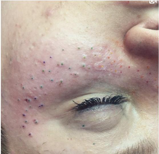 Mốt xăm tàn nhang đáng yêu trên mặt đang khiến phái đẹp thế giới điên đảo-8