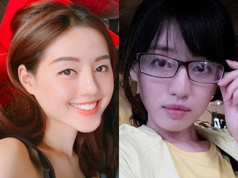 Khánh Linh The Face: 'Bố là người trực tiếp phẫu thuật sửa mũi cho mình'