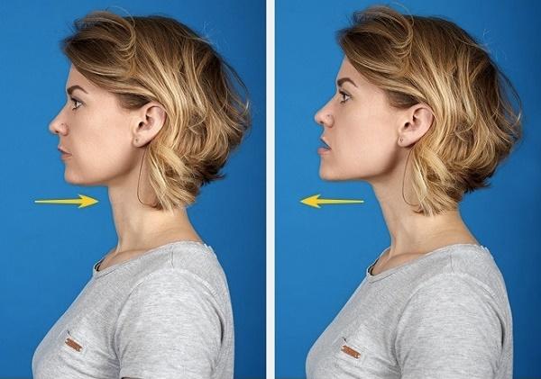 Cách làm cằm thon gọn nhanh nhất chỉ mất 15 phút -3