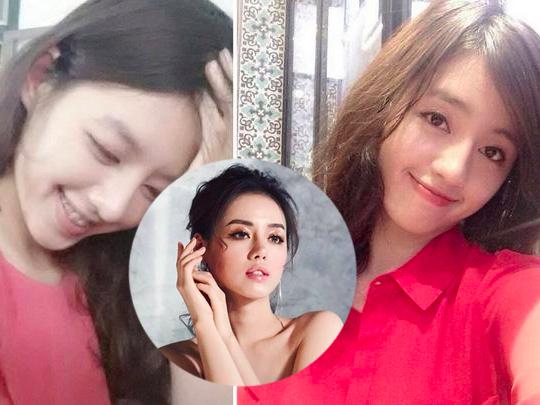 Khánh Linh The Face: 'Niềng răng là một trải nghiệm rất vất vả, đau đớn có cả máu và nước mắt'