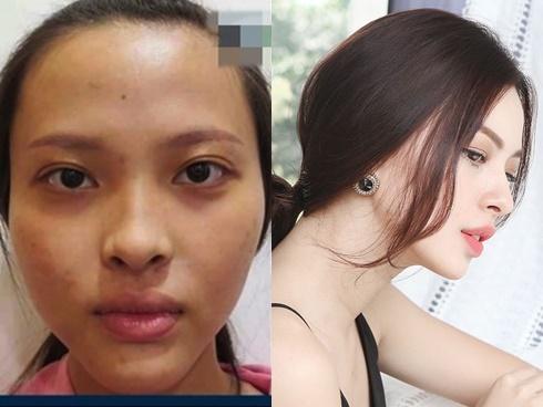 Tú Hảo The Face dập tan tin đồn phẫu thuật thẩm mỹ