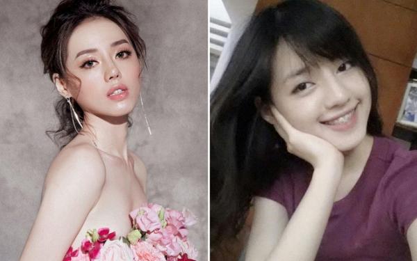 Sao Việt Phẫu thuật thẩm mỹ -5