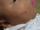 Hà Nội: Mẹ bận trong bếp, khỉ bất ngờ trèo lan can vào nhà cào mặt con gái 2 tháng tuổi