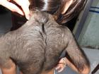Tin nóng trong ngày 27/6: Bé gái 5 tuổi mọc lông như người rừng ở Cà Mau