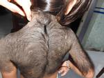 Tin nóng trong ngày 27/6: Bé gái 5 tuổi mọc lông như người rừng ở Cà Mau