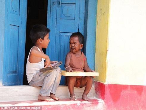 Người đàn ông 50 tuổi trong hình hài trẻ lên 5