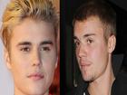 Justin Bieber ngày càng xuống sắc, lộ làn da bóng dầu đầy mụn