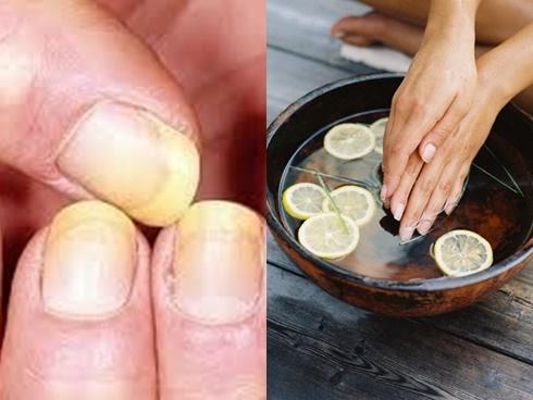 Làm nail quá nhiều khiến móng tay vàng khè dễ gãy, hãy cấp cứu bằng 4 mẹo sau