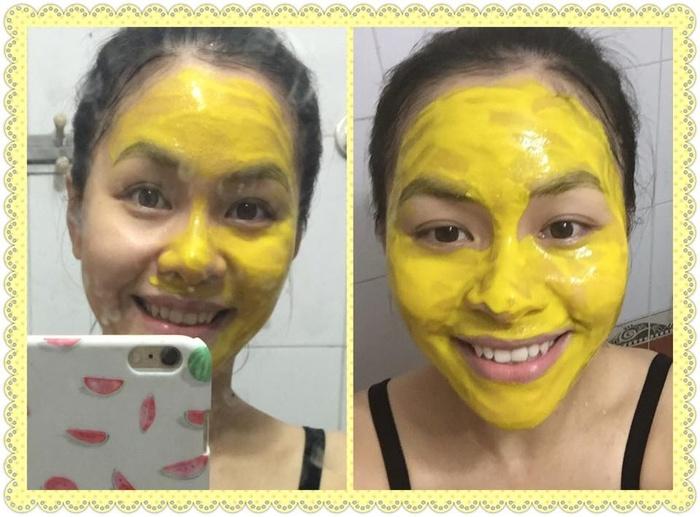 Bí kíp chữa mụn chỉ bằng cách đơn giản -3