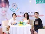 Beauty Bloggers tư vấn chăm sóc làn da sau mụn