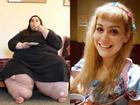 Hạnh phúc vỡ òa của cô gái nặng 300kg lột xác thần kỳ nhờ giảm cân