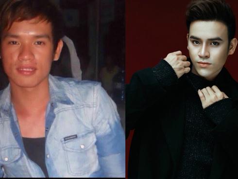 9x chi 200 triệu để phẫu thuật thẩm mỹ, rũ bỏ hình ảnh xấu xí, quê mùa