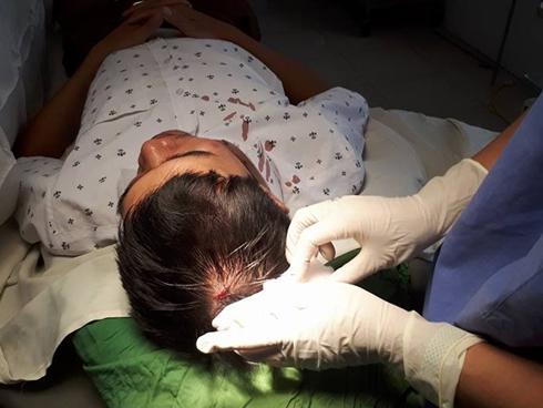 Bác sĩ bị người lạ tấn công rách đầu