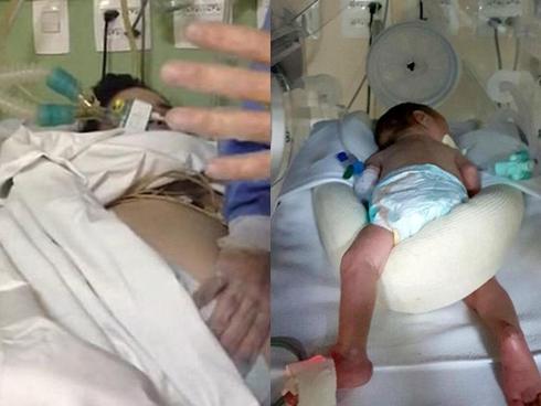 Bà mẹ bị chết não khi mang thai ở tuần thứ 9 nhưng 123 ngày sau 'phép lạ' xảy ra