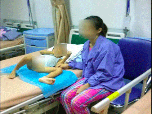 Xuất hiện thêm 22 bệnh nhi ở Hưng Yên bị sùi mào gà
