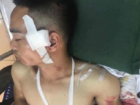 Cha thiệt mạng khi ngăn côn đồ xông vào bệnh viện truy sát con gái-3