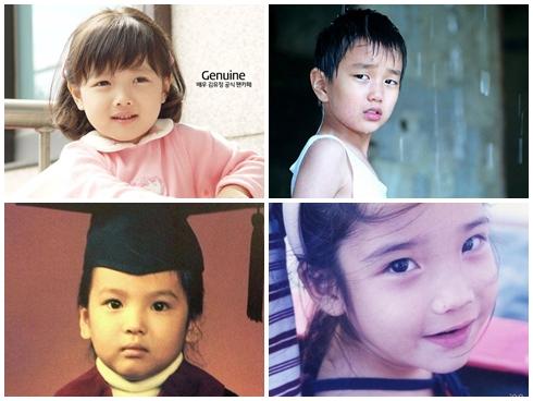 Quizz: Đoán tên sao qua loạt ảnh trước khi phẫu thuật thẩm mỹ-1