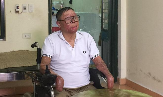 Anh Đinh Văn Dương, nạn nhân sống sót sau vụ máy bay rơi ở Hòa Lạc
