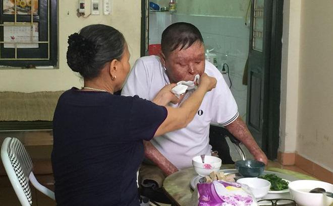 Anh Dương bên bữa cơm trưa được mẹ đút tại Trung tâm điều dưỡng thương binh.