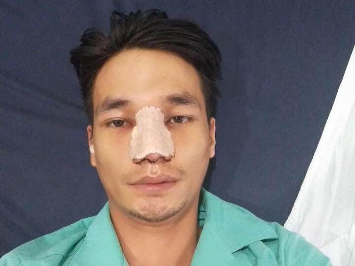 Hình ảnh đẹp trai của Lệ Rơi sau phẫu thuật thẩm mỹ khiến nhiều người ngỡ ngàng-3