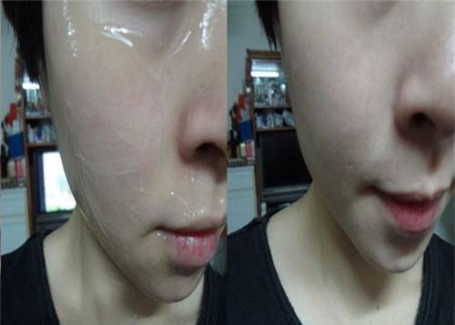 Hướng dẫn chi tiết cách uống và thoa vitamin E chuẩn nhất 100% khiến da chỉ có đẹp xuất sắc trở lên-6