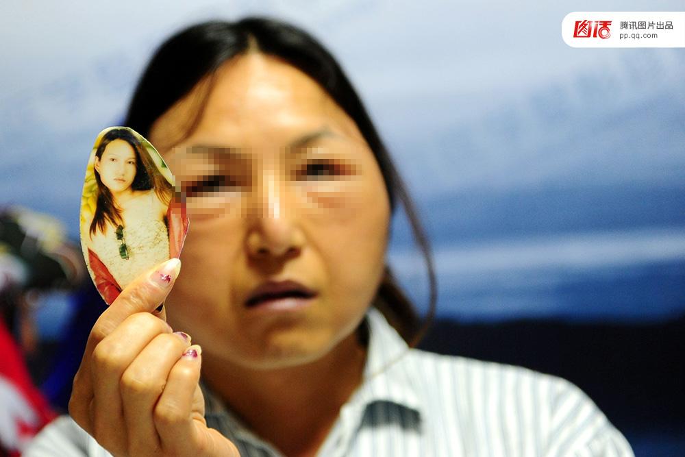 Tiền mất tật mang, thân tàn ma dại chỉ vì phẫu thuật thẩm mỹ 'chui'-1