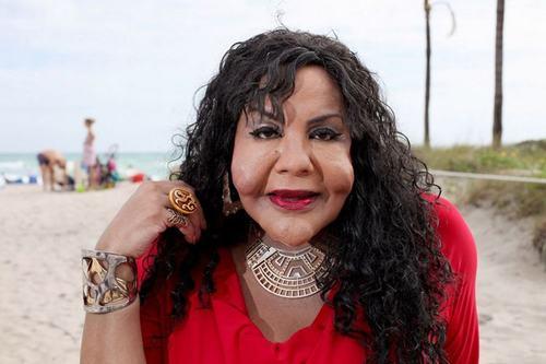 Tiền mất tật mang, thân tàn ma dại chỉ vì phẫu thuật thẩm mỹ 'chui'-2