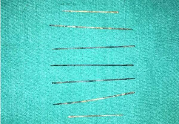 Bé gái 3 tuổi tử vong do bị ông chủ của mẹ đâm kim làm phép-2