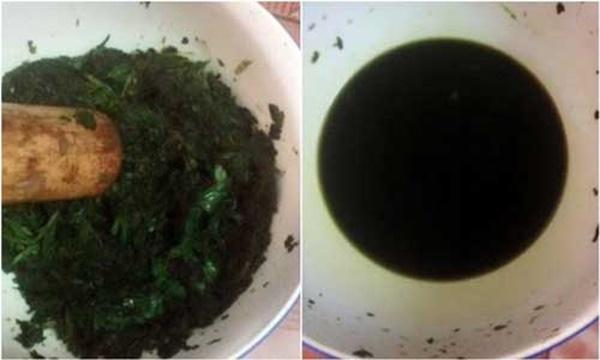 Với 2 ngàn đồng có ngay 2 cách trị mụn thịt quanh mắt 'một đi không trở lại'-3