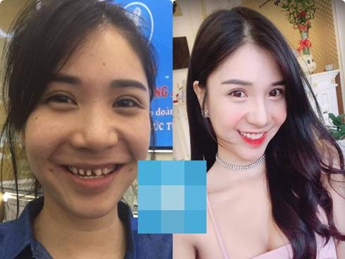 Bức ảnh HOT nhất trong ngày: Thanh Bi lộ hình kém duyên thời 'răng mỗi nơi một chiếc'