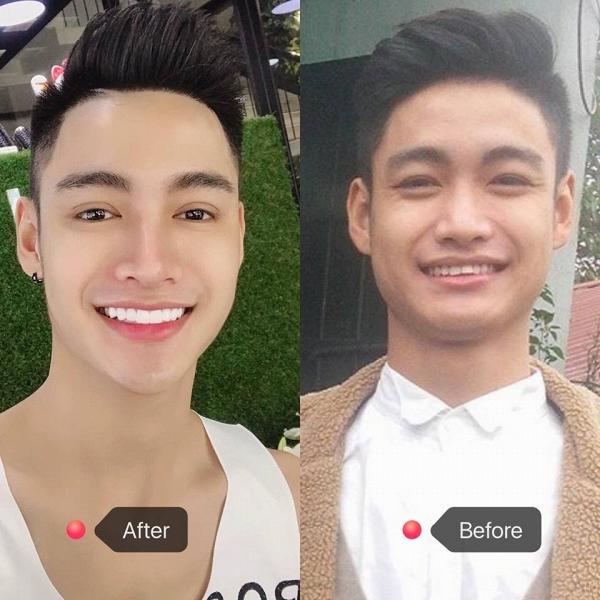 Ngoài Đức Phúc, không ít gương mặt đẹp ngỡ ngàng nhờ phẫu thuật thẩm mỹ-2