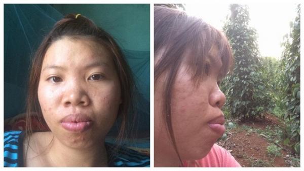 Ngoài Đức Phúc, không ít gương mặt đẹp ngỡ ngàng nhờ phẫu thuật thẩm mỹ-3