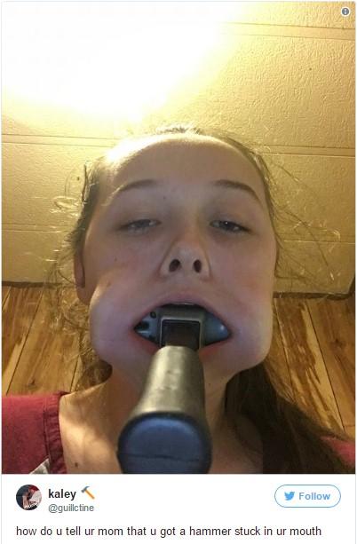 Cô gái nhét búa vào miệng để chứng tỏ tình yêu với thần tượng K-pop-2