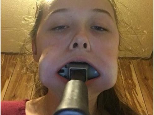 Cô gái nhét búa vào miệng để chứng tỏ tình yêu với thần tượng K-pop