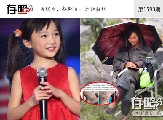 Mặt trái sau ánh hào quang của sao nhí: nhập viện vì kiệt sức, ôn bài trên giường bệnh-8