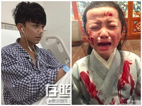 Mặt trái sau ánh hào quang của sao nhí: nhập viện vì kiệt sức, ôn bài trên giường bệnh