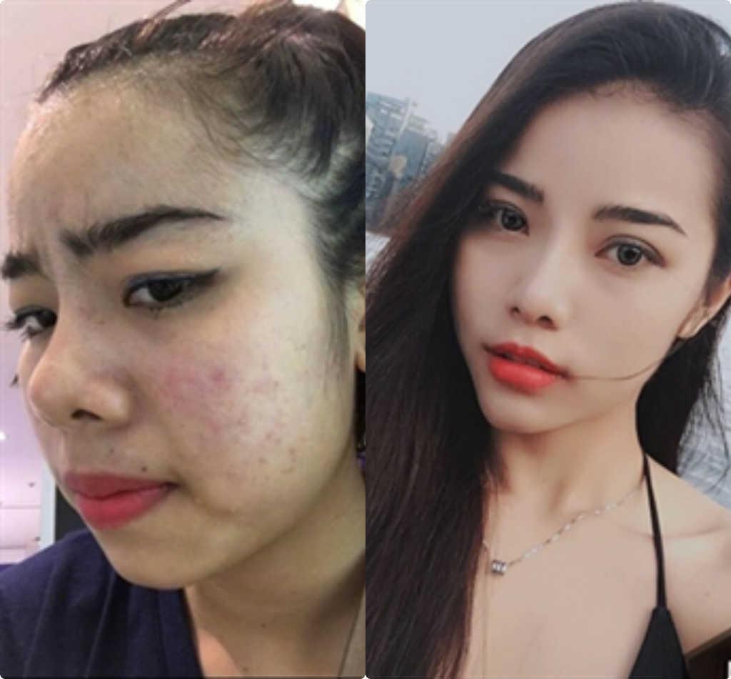 Mãn nhãn ngắm 9X Cần Thơ từ 'vịt hóa thiên nga' nhờ dao kéo-1