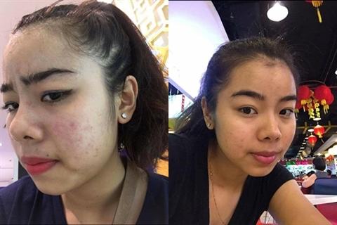 Mãn nhãn ngắm 9X Cần Thơ từ 'vịt hóa thiên nga' nhờ dao kéo-2