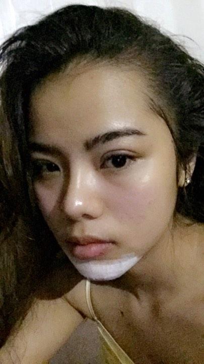 Mãn nhãn ngắm 9X Cần Thơ từ 'vịt hóa thiên nga' nhờ dao kéo-4