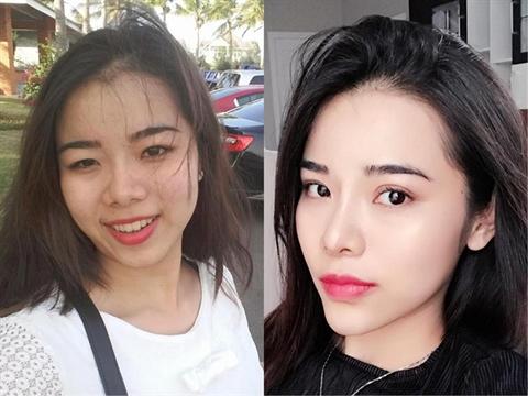 Mãn nhãn ngắm 9X Cần Thơ từ 'vịt hóa thiên nga' nhờ dao kéo-6