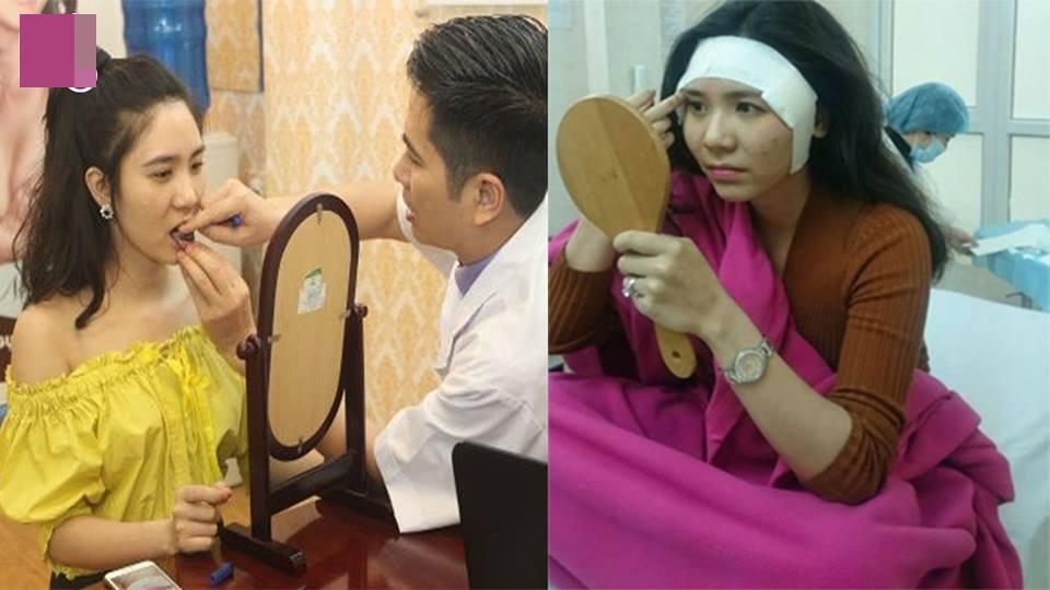 Cận cảnh quá trình phẫu thuật độn thái dương của Thanh Bi 'Người Phán Xử'-1