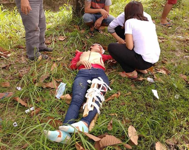 Đuổi theo 2 tên cướp, nữ công nhân gãy chân-1