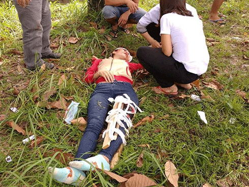 Đuổi theo 2 tên cướp, nữ công nhân gãy chân