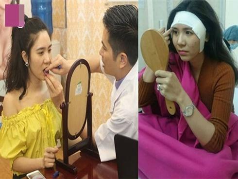 Cận cảnh quá trình phẫu thuật độn thái dương của Thanh Bi 'Người Phán Xử'-13