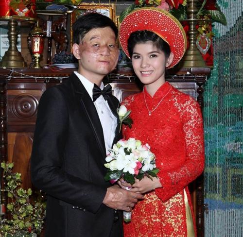 Những cặp đôi 'đũa lệch' ai nhìn cũng 'phát ngán' nhưng lại sống hạnh phúc bên nhau-2