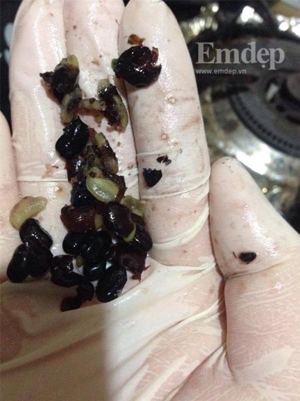 Tin nóng trong ngày 2/8: Đang bơm tạp chất rau câu vào tôm ươn, một cơ sở ở Hà Nội bị bắt tại trận-4